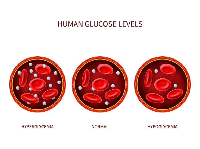 Blood Glucose Fasting